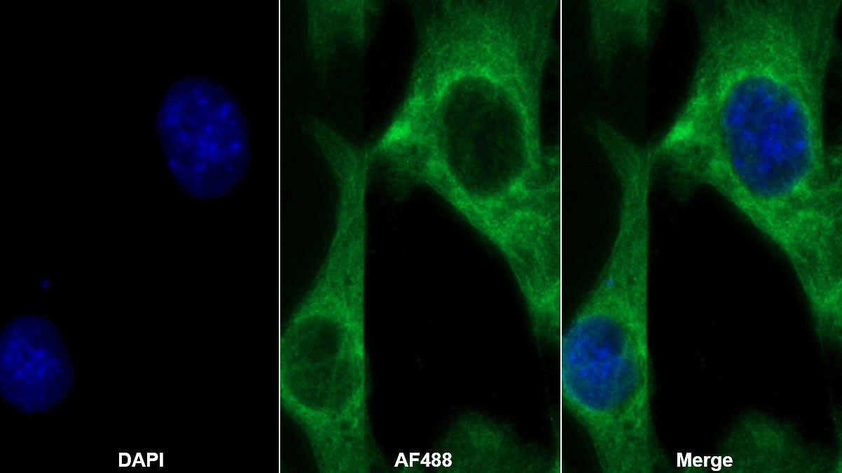 Polyclonal Antibody to Deoxythymidylate Kinase (DTYMK)