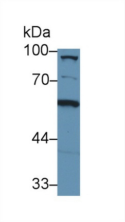 Polyclonal Antibody to Complement Component 8a (C8a)