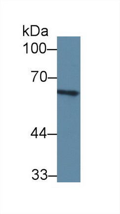 Polyclonal Antibody to Complement Component 8a (C8a)