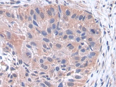 Polyclonal Antibody to Phospholipase A2, Pancreas (pPLA2)