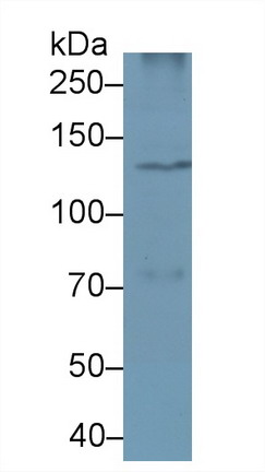 Polyclonal Antibody to Phospholipase C Beta 4 (PLCb4)