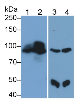 Polyclonal Antibody to Phospholipase C Delta 3 (PLCd3)