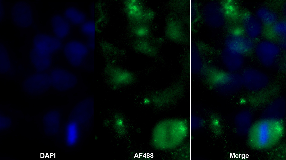 Polyclonal Antibody to Phospholipase C Delta 3 (PLCd3)
