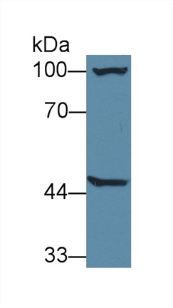 Polyclonal Antibody to Alanine Glyoxylate Aminotransferase 2 (AGXT2)