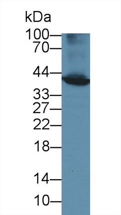 Polyclonal Antibody to Branched Chain Aminotransferase 1, Cytosolic (BCAT1)