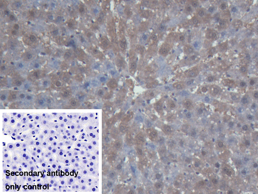 Polyclonal Antibody to Branched Chain Aminotransferase 1, Cytosolic (BCAT1)