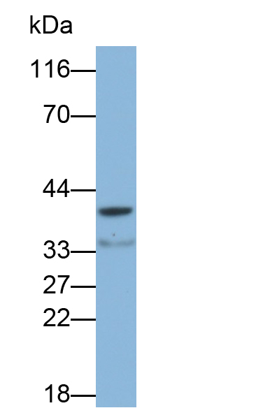 Polyclonal Antibody to Branched Chain Aminotransferase 2, Mitochondrial (BCAT2)