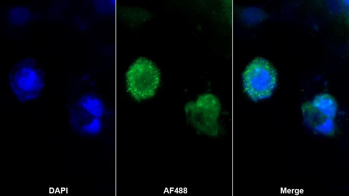 Polyclonal Antibody to Dipeptidyl Peptidase 3 (DPP3)