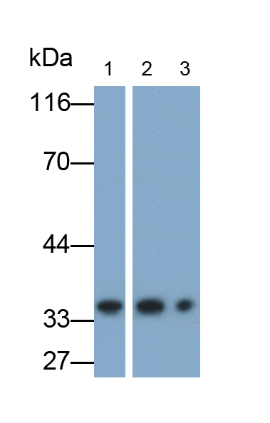 Polyclonal Antibody to Small Nuclear Ribonucleoprotein Polypeptide A (SNRPA)