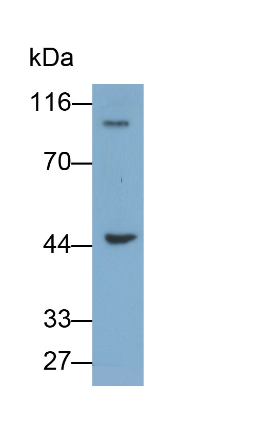 Polyclonal Antibody to Dipeptidyl Peptidase 8 (DPP8)