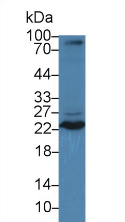 Polyclonal Antibody to Tumor Necrosis Factor Ligand Superfamily, Member 12 (TNFSF12)