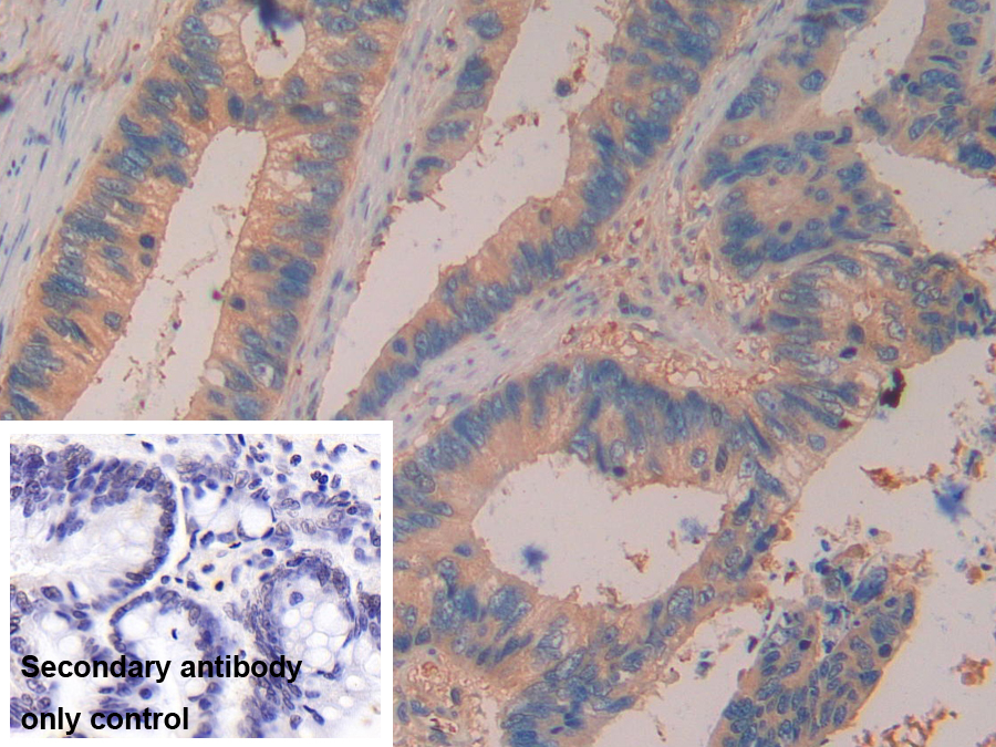 Polyclonal Antibody to Dimethylarginine Dimethylaminohydrolase 2 (DDAH2)