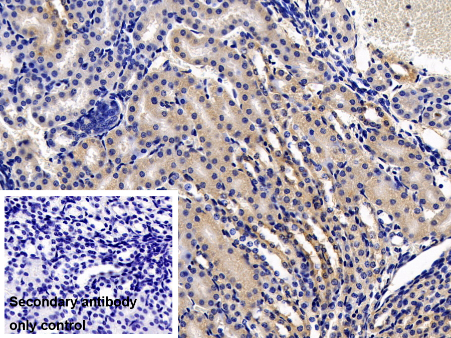 Polyclonal Antibody to Dimethylarginine Dimethylaminohydrolase 2 (DDAH2)