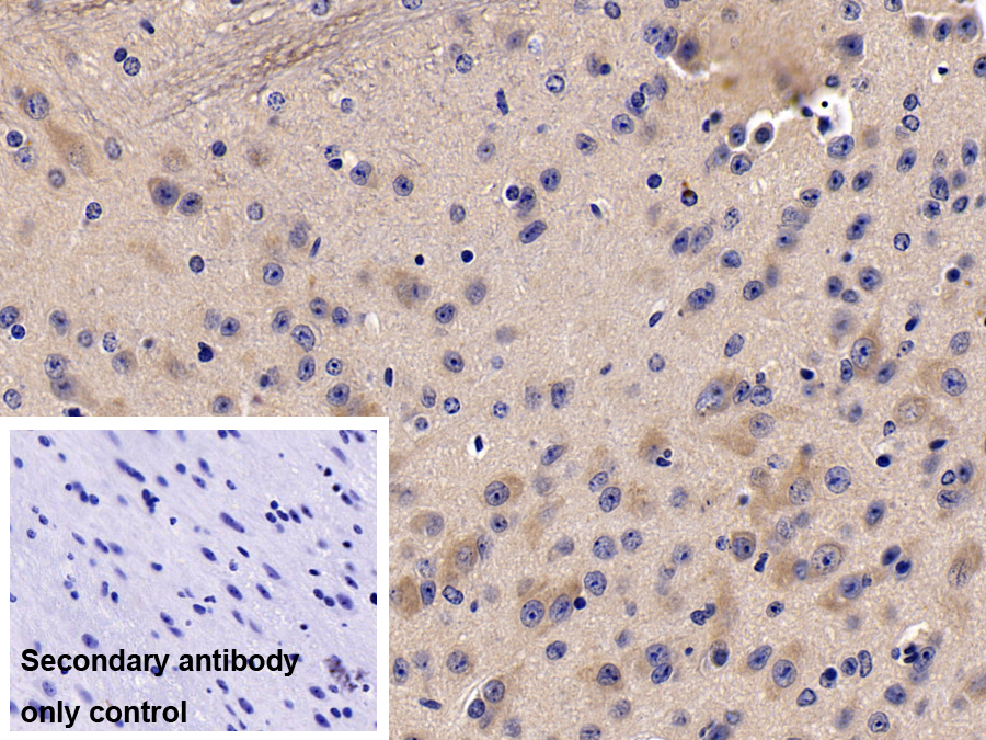 Polyclonal Antibody to Dimethylarginine Dimethylaminohydrolase 2 (DDAH2)