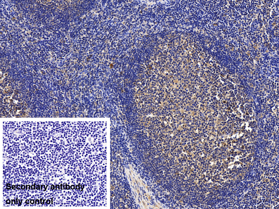 Polyclonal Antibody to Procollagen C Proteinase Enhancer 2 (PCPE2)