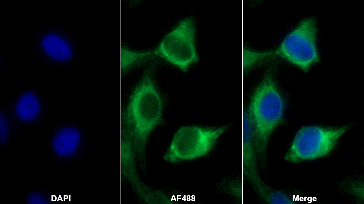 Polyclonal Antibody to Perilipin 3 (PLIN3)
