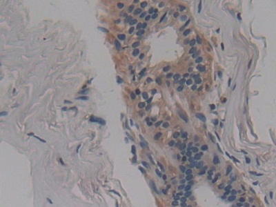 Polyclonal Antibody to Neutral Sphingomyelinase Activation Associated Factor (NSMAF)