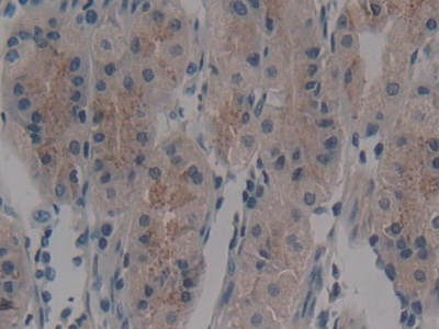 Polyclonal Antibody to Neutral Sphingomyelinase Activation Associated Factor (NSMAF)