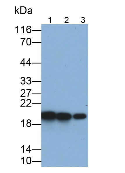 Polyclonal Antibody to Cannabinoid Receptor Interacting Protein 1 (CNRIP1)