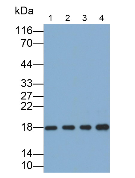 Polyclonal Antibody to Cannabinoid Receptor Interacting Protein 1 (CNRIP1)