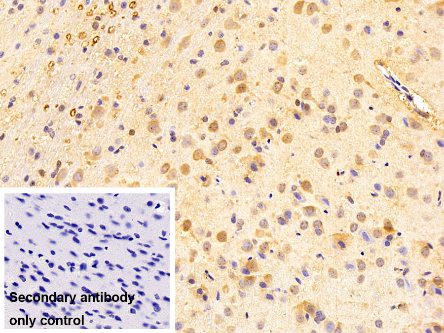 Polyclonal Antibody to Ephrin A5 (EFNA5)