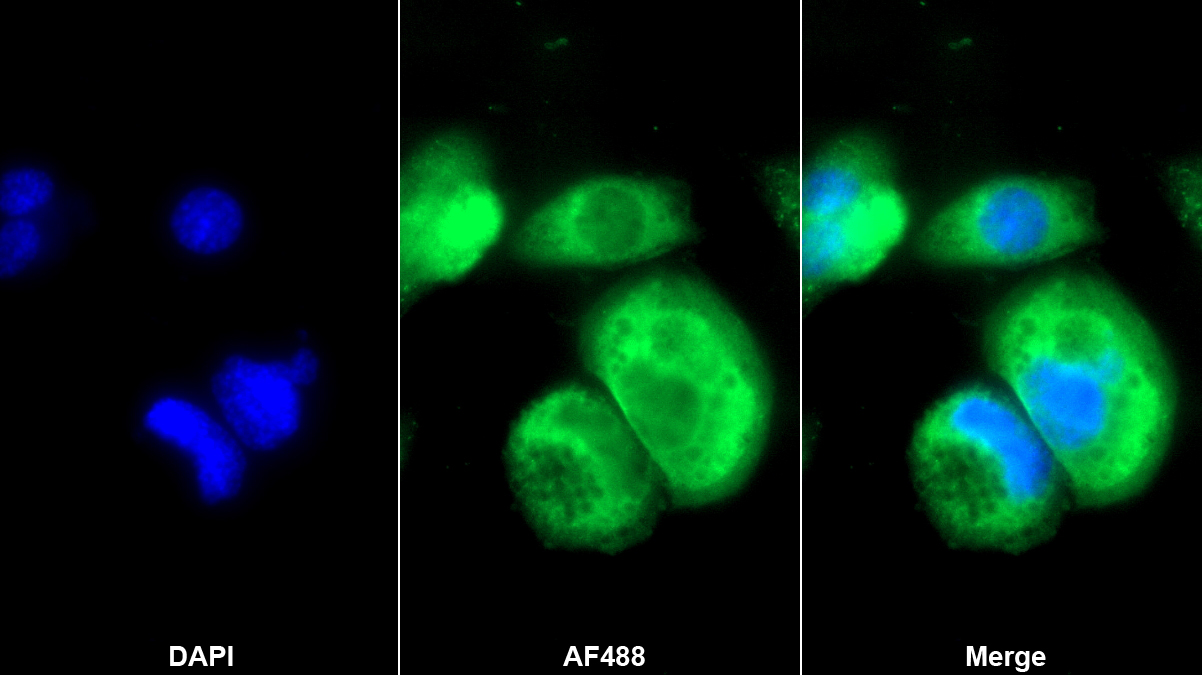 Polyclonal Antibody to Lactate Dehydrogenase C (LDHC)