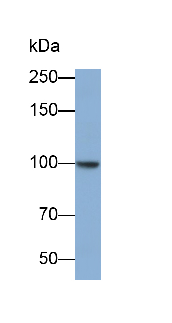 Polyclonal Antibody to Adenosine Deaminase, RNA Specific (ADAR)