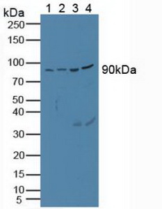 Polyclonal Antibody to Proprotein Convertase Subtilisin/Kexin Type 1 (PCSK1)