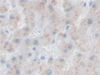 Polyclonal Antibody to Proprotein Convertase Subtilisin/Kexin Type 1 (PCSK1)