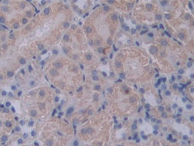 Polyclonal Antibody to Proprotein Convertase Subtilisin/Kexin Type 1 (PCSK1)