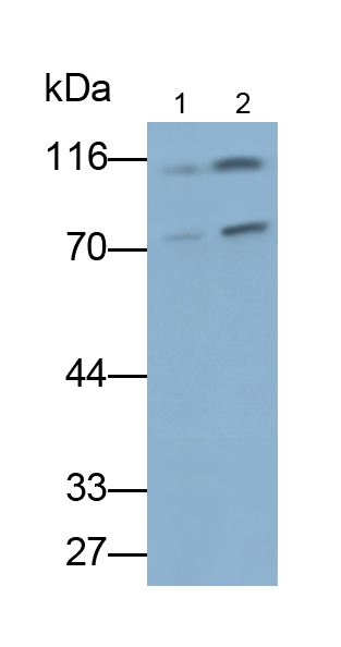 Polyclonal Antibody to Puromycin Sensitive Aminopeptidase (PSA)