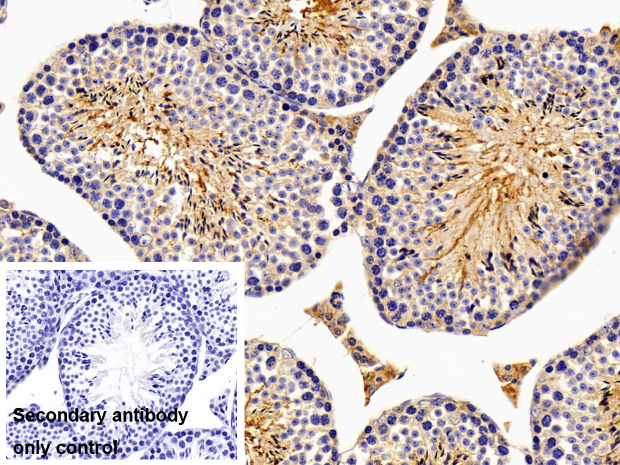 Polyclonal Antibody to Puromycin Sensitive Aminopeptidase (PSA)