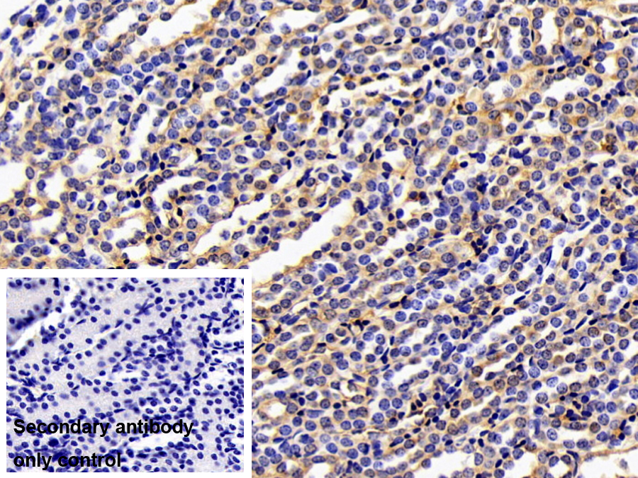 Polyclonal Antibody to Puromycin Sensitive Aminopeptidase (PSA)