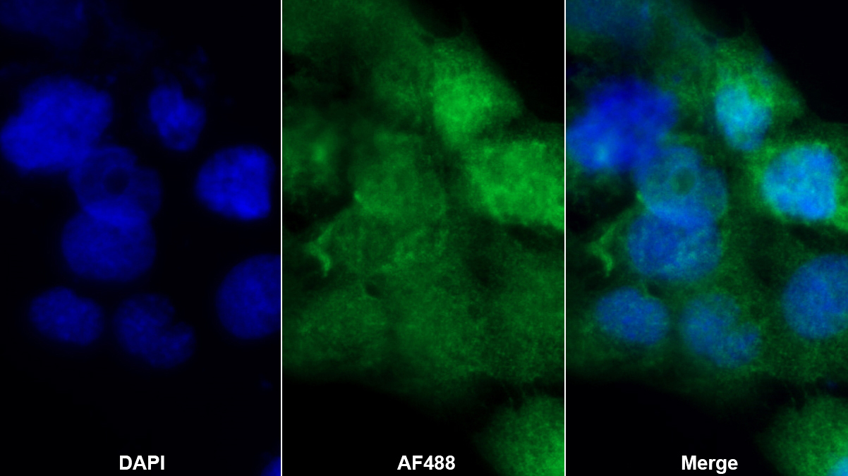 Polyclonal Antibody to Protein Tyrosine Kinase 6 (PTK6)