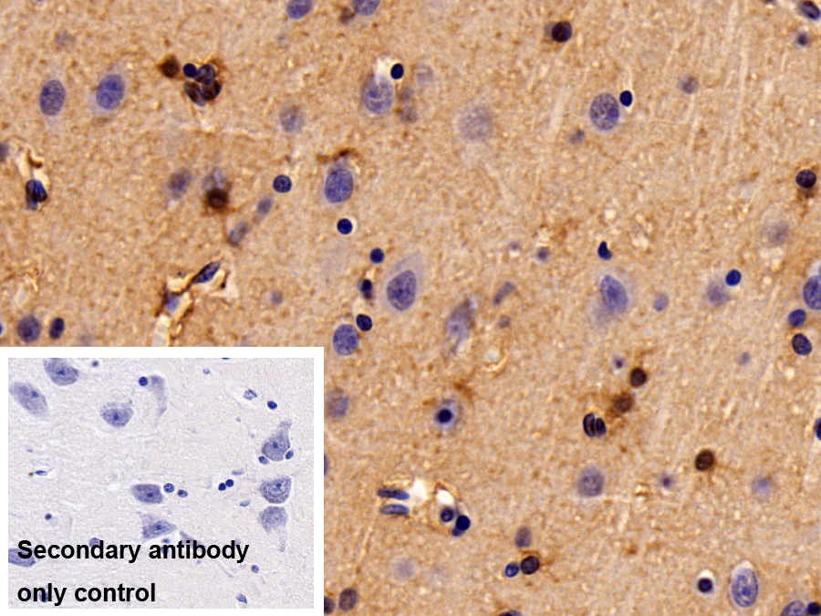 Polyclonal Antibody to Synaptic Ras GTPase Activating Protein 1 (SYNGAP1)