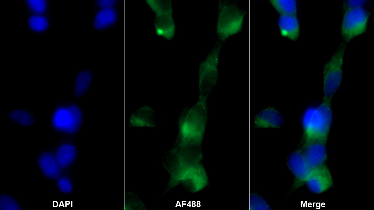 Polyclonal Antibody to Ras Homolog Gene Family, Member Q (RHOQ)