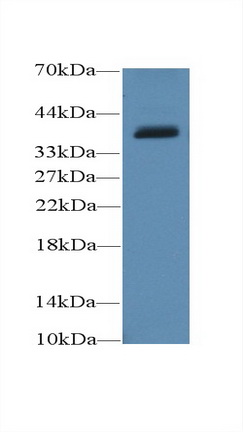 Polyclonal Antibody to Uncoupling Protein 4, Mitochondrial (UCP4)