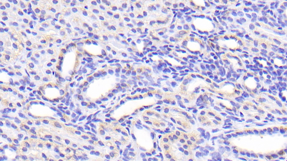 Polyclonal Antibody to Solute Carrier Family 39, Member 7 (SLC39A7)
