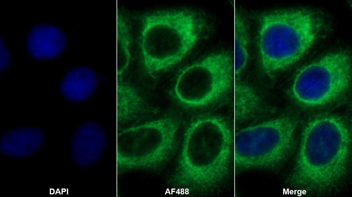 Polyclonal Antibody to Electron Transfer Flavoprotein Alpha Polypeptide (ETFa)