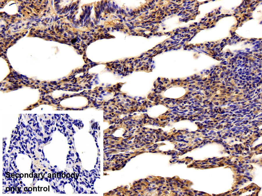Polyclonal Antibody to Phosphoglycerate Mutase 1, Brain (PGAM1)