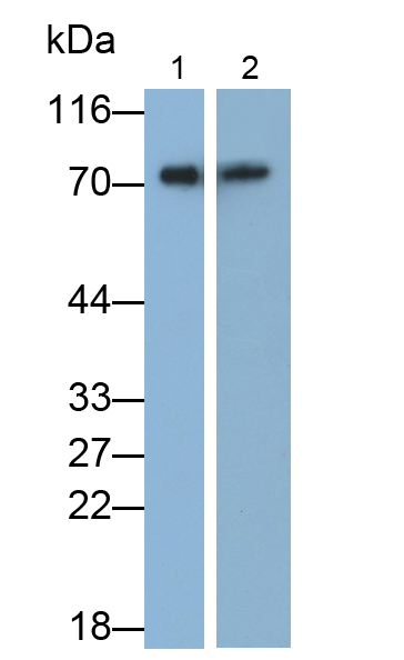 Polyclonal Antibody to Alpha-1-B-Glycoprotein (a1BG)