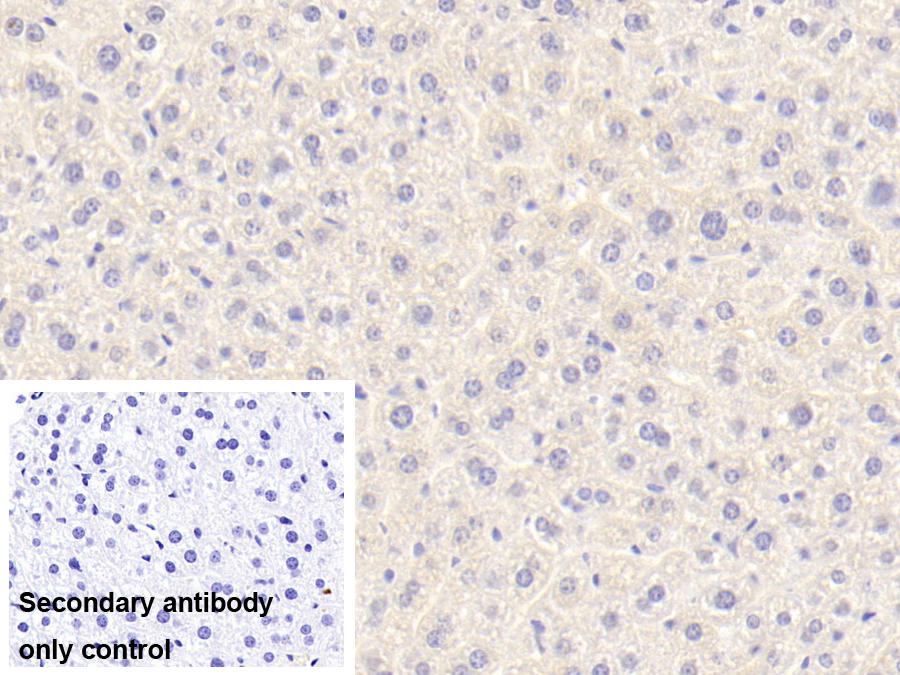 Polyclonal Antibody to Alpha-1-B-Glycoprotein (a1BG)