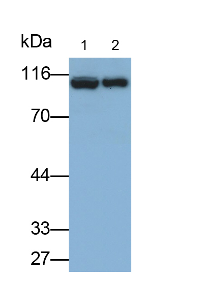 Polyclonal Antibody to Alpha-1-B-Glycoprotein (a1BG)