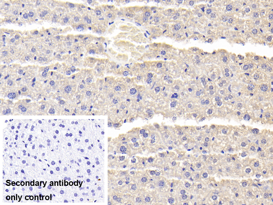 Polyclonal Antibody to Alpha-1-B-Glycoprotein (a1BG)