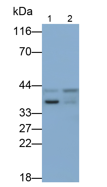 Polyclonal Antibody to B-Cell CLL/Lymphoma 7A (Bcl7A)