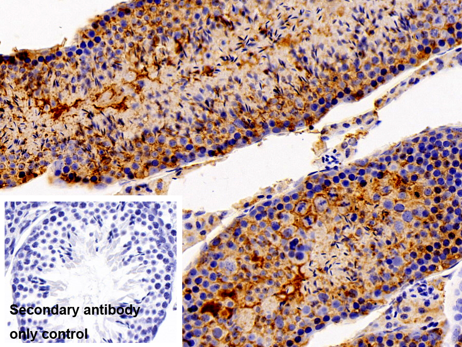 Polyclonal Antibody to Huntingtin Interacting Protein 2 (HIP2)