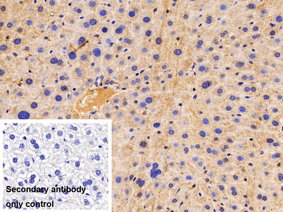 Polyclonal Antibody to Huntingtin Interacting Protein 2 (HIP2)