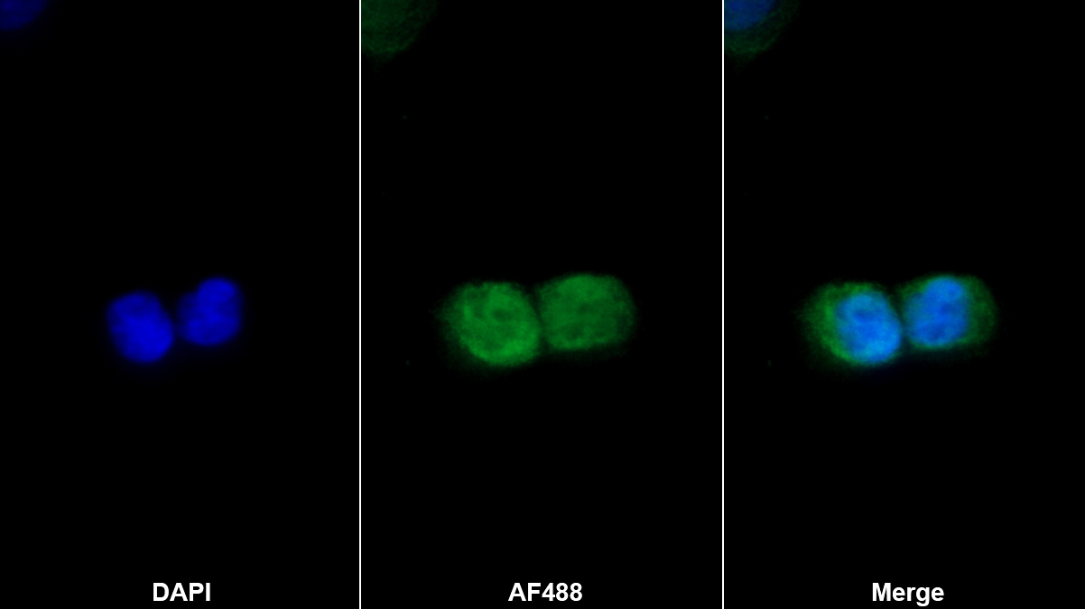 Polyclonal Antibody to Minichromosome Maintenance Deficient 5 (MCM5)