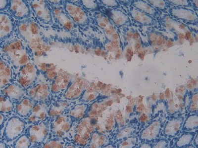 Polyclonal Antibody to Glomulin (GLMN)