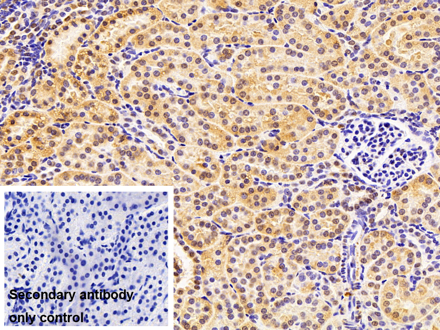 Polyclonal Antibody to Selenoprotein X1 (SEPX1)